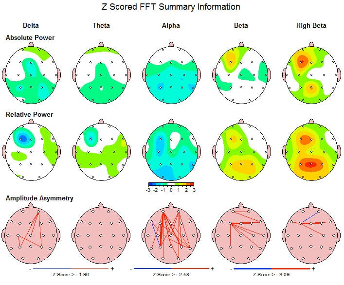 EEG Brain map